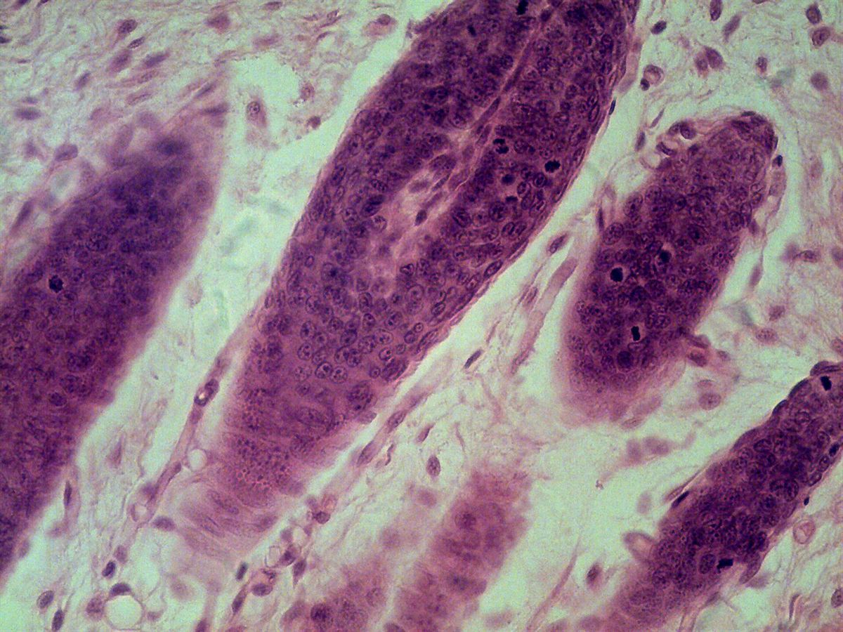 Folículos pilosos vistos al microscopio, teñidos de violeta